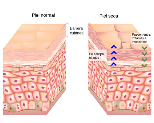 Barrera cutanea piel normal piel seca