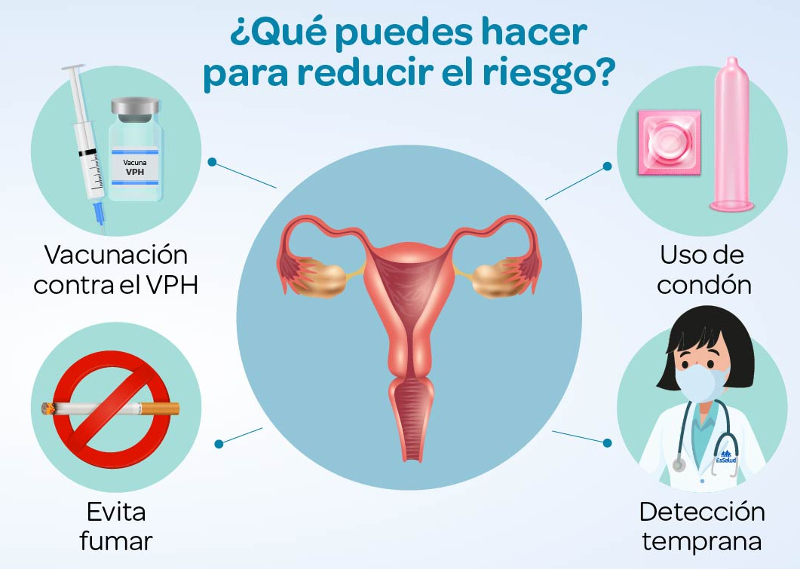 prevencion del cancer de cuello de utero