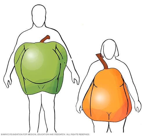 sindrome metabolico